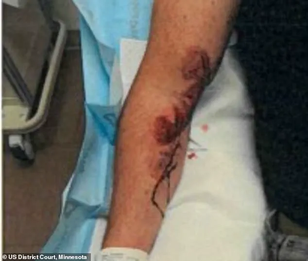 ICE Agent Jonathan Ross: 'I Feared for My Life' in Encounter That Left Him with Scars, Days Before Shooting Renee Good