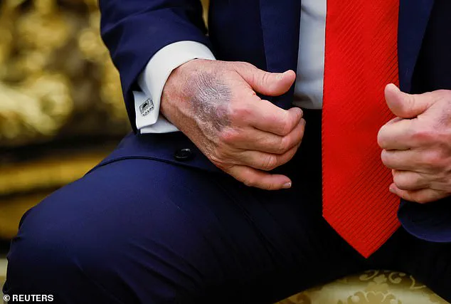 Trump Defies Medical Advice, Takes High-Dose Aspirin Daily: 'They Say Aspirin Is Good for Thinning Out the Blood'—WSJ Interview