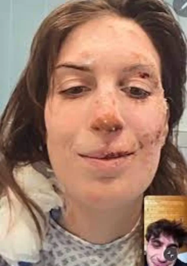 Eleonora Palmieri’s Ongoing Battle: Months Into a Years-Long Recovery From Tragedy