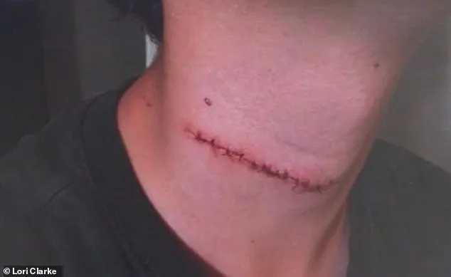 13-Year-Old Boy Survives Near-Fatal Slingshot Attack in Daytona Beach