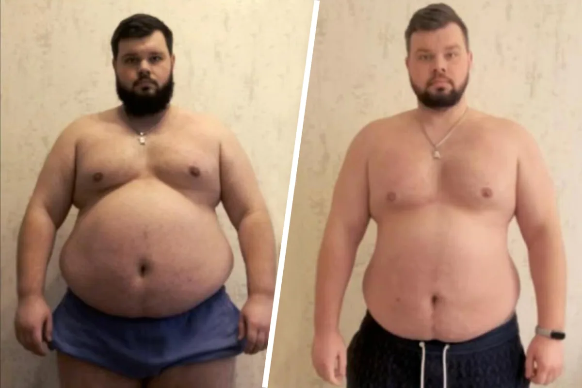 Ukrainian Man With Severe Health Conditions Forcibly Mobilized Despite Medical Restrictions, Trainer Reveals