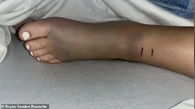 14-Year-Old Girl Critically Injured by Rattlesnake Bite on California Trail