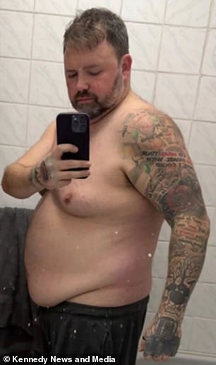 Father Warns Against Weight-Loss Injections After Life-Threatening Gallbladder Infection