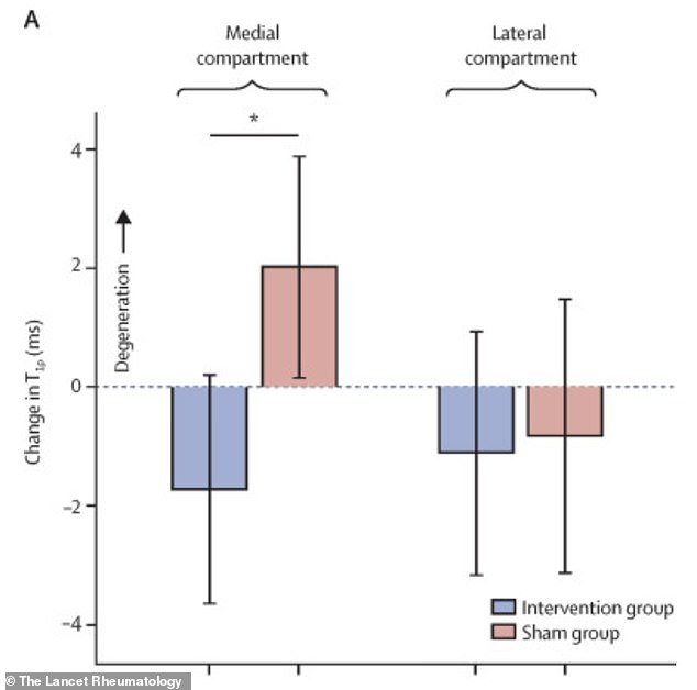 Stanford Study: Simple Walking Angle Change Alleviates Osteoarthritis Pain